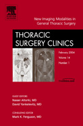 Thoracic Surgery Clinics Thoracic Surgery Clinics